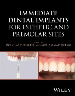 Cover Immediate Dental Implants for Esthetic and Premolar Sites