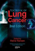 Textbook of Lung Cancer (eBook, ePUB)
