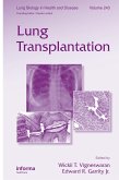 Lung Transplantation (eBook, ePUB)