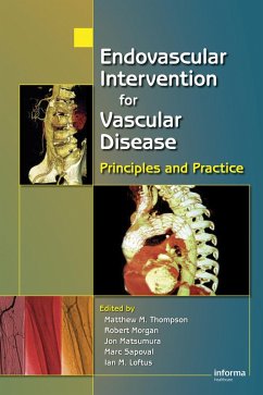 Cover Endovascular Intervention for Vascular Disease (eBook, ePUB)