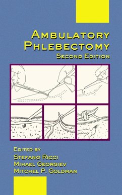 Cover Ambulatory Phlebectomy (eBook, ePUB)