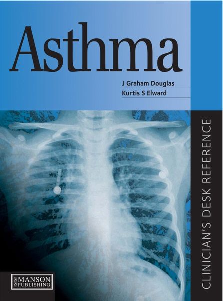 Asthma (eBook, ePUB)