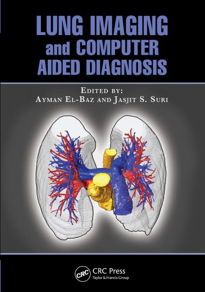 Lung Imaging and Computer Aided Diagnosis (eBook, ePUB) Lung Imaging and Computer Aided Diagnosis (eBook, ePUB)