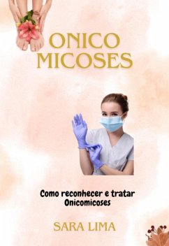 Onicomicoses (eBook, ePUB) - Lima, Sara