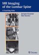 MR Imaging of the Lumbar Spine (eBook,... - Bild 1