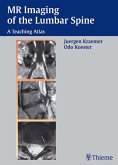 MR Imaging of the Lumbar Spine (eBook, ePUB)