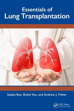 Essentials of Lung Transplantation (eBook, ePUB) - Bos, Saskia; Vos, Robin; Fisher, Andrew J.