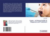 Caries - A Clinical Guide to Diagnosis and Treatment Caries - A Clinical Guide to Diagnosis and Treatment