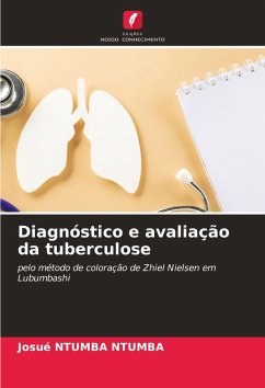 Diagnóstico e avaliação da tuberculose - NTUMBA NTUMBA, Josué