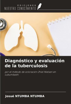 Cover Diagnóstico y evaluación de la tuberculosis