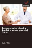 Leczenie raka piersi u kobiet w wieku powy¿ej 70 lat Leczenie raka piersi u kobiet w wieku powy¿ej 70 lat