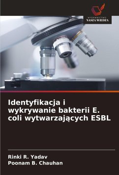 Cover Identyfikacja i wykrywanie bakterii E. coli wytwarzaj¿cych ESBL