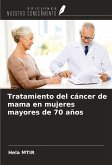 Tratamiento del cáncer de mama en mujeres mayores de 70 años Tratamiento del cáncer de mama en mujeres mayores de 70 años