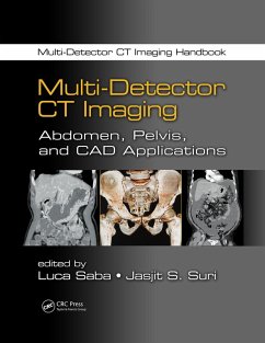 Multi-Detector CT Imaging (eBook, ePUB)