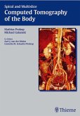 Spiral and Multislice Computed Tomography of the Body (eBook, ePUB)