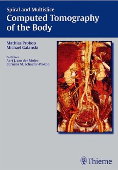 Spiral and Multislice Computed Tomography of the Body (eBook, ePUB)