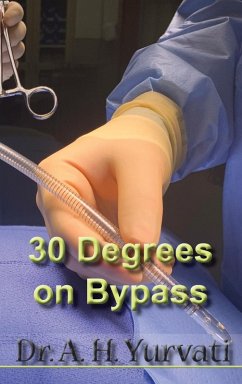 Cover 30 Degrees on Bypass