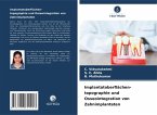 Implantatoberflächen- topographie und Osseointegration von Zahnimplantaten