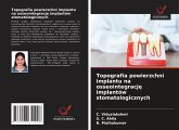 Topografia powierzchni implantu na osseointegracj¿ implantów stomatologicznych Topografia powierzchni implantu na osseointegracj¿ implantów stomatologicznych
