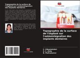 Topographie de la surface de l'implant sur l'ostéointégration des implants dentaires Topographie de la surface de l'implant sur l'ostéointégration des implants dentaires