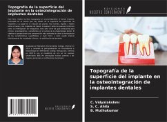 Topografía de la superficie del implante en la osteointegración de implantes dentales - Vidyalakshmi, C.; Ahila, S. C.; Muthukumar, B.