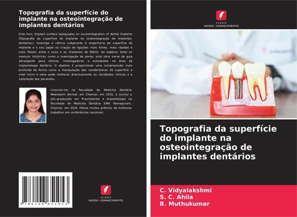 Topografia da superfície do implante na osteointegração de implantes dentários Topografia da superfície do implante na osteointegração de implantes dentários