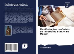 Cover Manifestações orofaciais do linfoma de Burkitt no Malawi