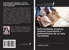 Enfermedades fúngicas, sistema inmunitario y polimorfismos de un solo nucleótido - Iyalla, Caroline Enfermedades fúngicas, sistema inmunitario y polimorfismos de un solo nucleótido - Iyalla, Caroline