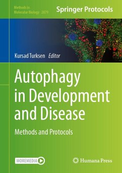 Autophagy in Development and Disease (eBook, PDF)
