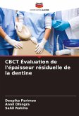 CBCT Évaluation de l'épaisseur résiduelle de la dentine CBCT Évaluation de l'épaisseur résiduelle de la dentine