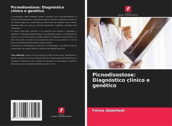 Picnodisostose: Diagnóstico clínico e genético Picnodisostose: Diagnóstico clínico e genético
