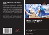 Ocena CBCT grubo¿ci resztkowej z¿biny Ocena CBCT grubo¿ci resztkowej z¿biny
