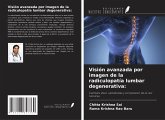 Visión avanzada por imagen de la radiculopatía lumbar degenerativa: Visión avanzada por imagen de la radiculopatía lumbar degenerativa: