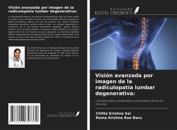 Visión avanzada por imagen de la radiculopatía lumbar degenerativa: Visión avanzada por imagen de la radiculopatía lumbar degenerativa: