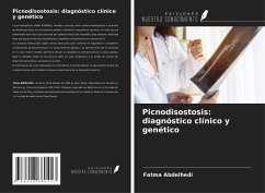 Picnodisostosis: diagnóstico clínico y genético - Abdelhedi, Fatma