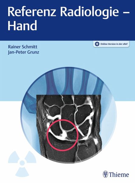 Referenz Radiologie - Hand (eBook, ePUB)