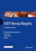 Etep Hernia Repairs Etep Hernia Repairs