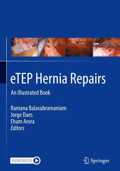 eTEP Hernia Repairs