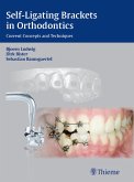 Self-Ligating Brackets in Orthodontics (eBook, ePUB)