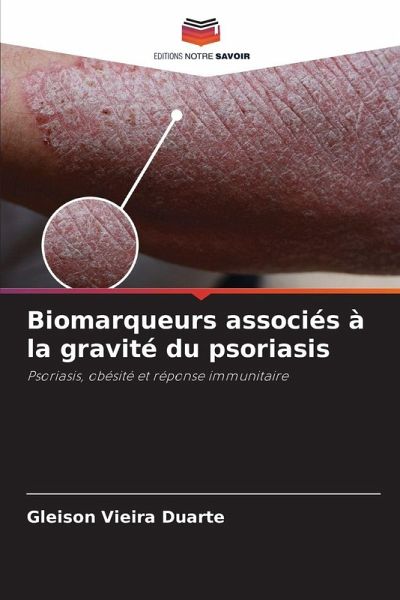 Biomarqueurs associés à la gravité du psoriasis Biomarqueurs associés à la gravité du psoriasis