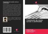 Tratamento de canais curvos e calcificados Tratamento de canais curvos e calcificados