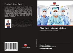Cover Fixation interne rigide