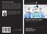 Fijación interna rígida Fijación interna rígida