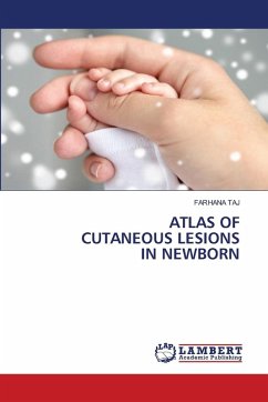 Atlas of Cutaneous Lesions in Newborn Atlas of Cutaneous Lesions in Newborn
