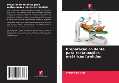 Cover Preparação do dente para restaurações metálicas fundidas