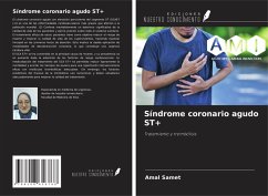 Cover Síndrome coronario agudo ST+