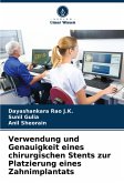 Verwendung und Genauigkeit eines chirurgischen Stents zur Platzierung eines Zahnimplantats Verwendung und Genauigkeit eines chirurgischen Stents zur Platzierung eines Zahnimplantats
