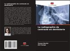 La radiographie de contraste en dentisterie La radiographie de contraste en dentisterie