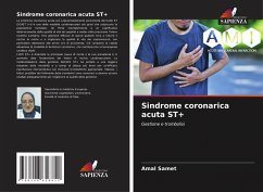 Cover Sindrome coronarica acuta ST+
