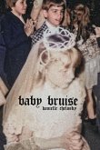Baby Bruise